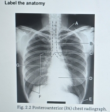 Solved: Label the anatomy Fig. 2.2 Posteroanterior (PA) chest ...