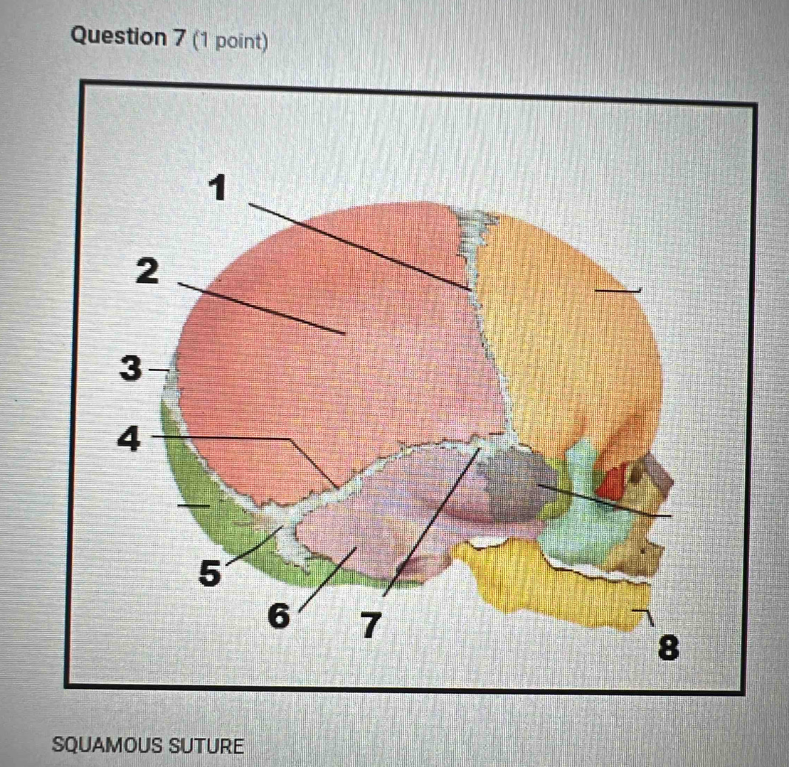 SQUAMOUS SUTURE