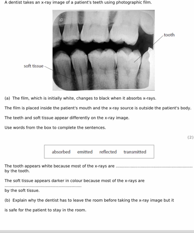 A dentist takes an x -ray image of a patient's teeth using photographic film.
(a) The film, which is initially white, changes to black when it absorbs x -rays.
The film is placed inside the patient's mouth and the x -ray source is outside the patient's body.
The teeth and soft tissue appear differently on the x -ray image.
Use words from the box to complete the sentences.
(2)
absorbed emitted reflected transmitted
The tooth appears white because most of the x -rays are_
by the tooth.
The soft tissue appears darker in colour because most of the x -rays are
_
by the soft tissue.
(b) Explain why the dentist has to leave the room before taking the x -ray image but it
is safe for the patient to stay in the room.