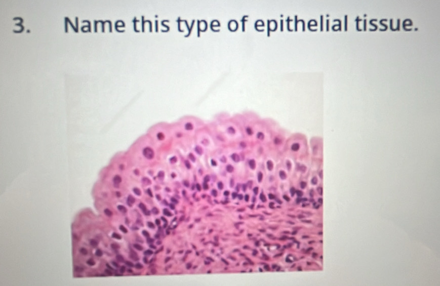 Name this type of epithelial tissue.