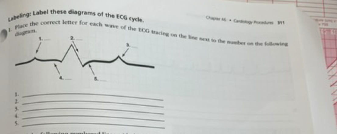 Labeling: Label these diagrams of the ECG cycle. 
Chapter 46 * Cardiology Procedures 311 H lonç 
, 
1. Place the correct letter for each wave of the ECG trac on the line next to the number on the following gram. 
1._ 
2._ 
_3 
4._ 
5._