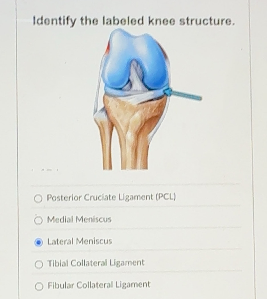 Gelöst:Identify the labeled knee structure. Posterior Cruciate Ligament ...