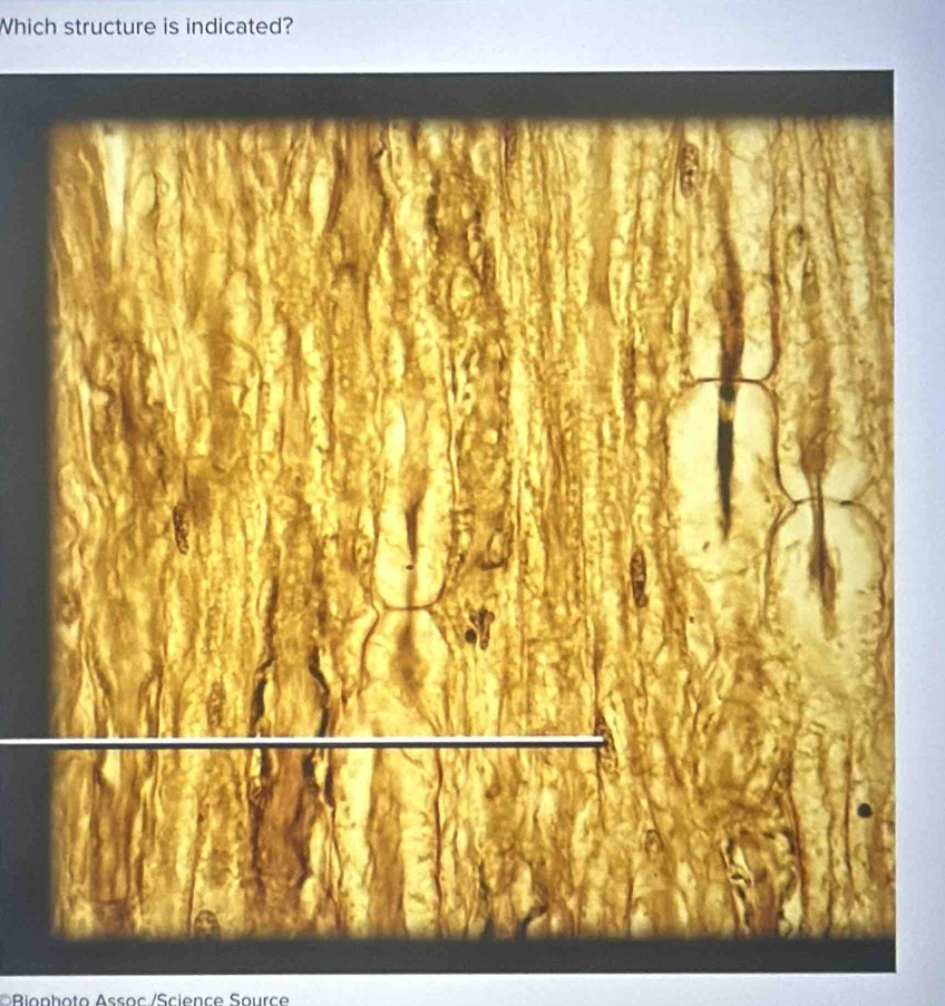 Which structure is indicated? 
A Biophoto Assoc /Science Source