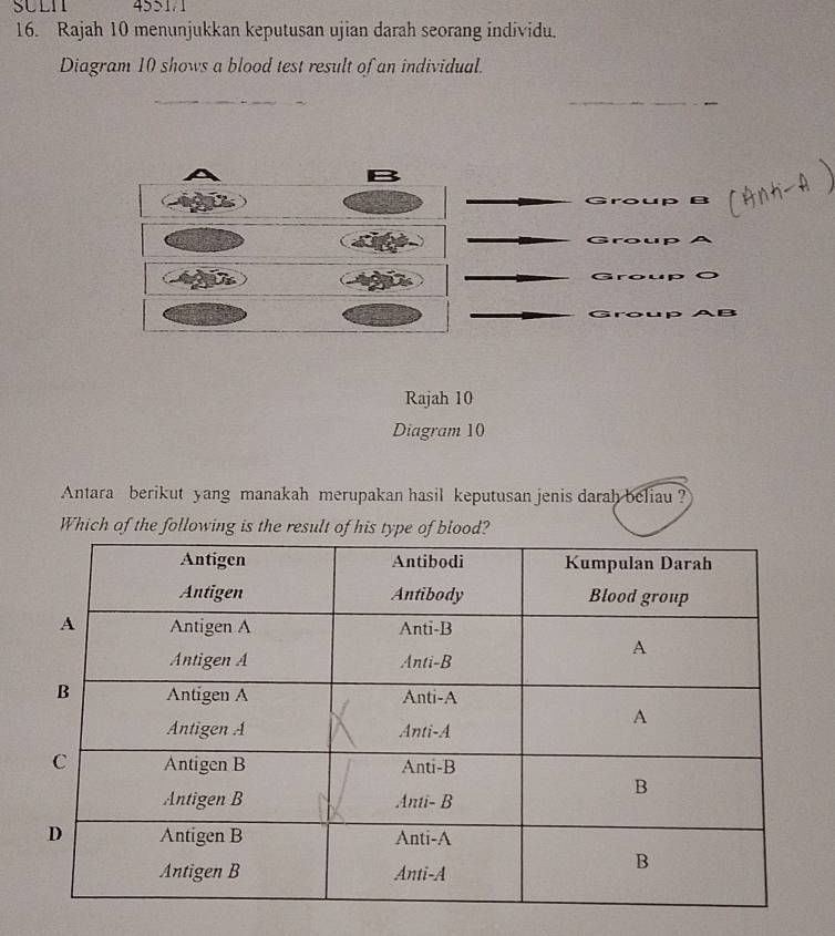 SULI 4551/1
16. Rajah 10 menunjukkan keputusan ujian darah seorang individu.
Diagram 10 shows a blood test result of an individual.
_
_
Group B
 Group A
Group O
Group AB
Rajah 10
Diagram 10
Antara berikut yang manakah merupakan hasil keputusan jenis darah beliau ?
Which of the following is the result of his type of blood?