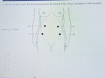 In which location will the fetal heart tones be heard if the fetus' position is left occiput
anterior (LOA)
3
b
C
d