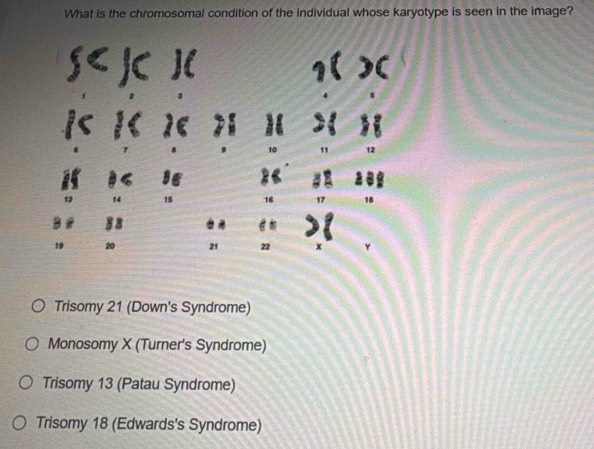 What is the chromosomal condition of the individual whose karyotype is seen in the image?
S< JC ](
|< 1< λ< >1
8 . 10 " 12
i 6 ie «
13 14 15 16 17 18
58
19 20 21 22 x Y
Trisomy 21 (Down's Syndrome)
Monosomy X (Turner's Syndrome)
Trisomy 13 (Patau Syndrome)
Trisomy 18 (Edwards's Syndrome)