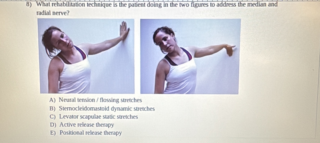 What rehabilitation technique is the patient doing in the two figures to address the median and
radial nerve?
A) Neural tension / flossing stretches
B) Sternocleidomastoid dynamic stretches
C) Levator scapulae static stretches
D) Active release therapy
E) Positional release therapy