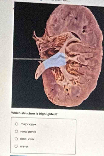 major calyx
renal pelvis
renal vein
ureter