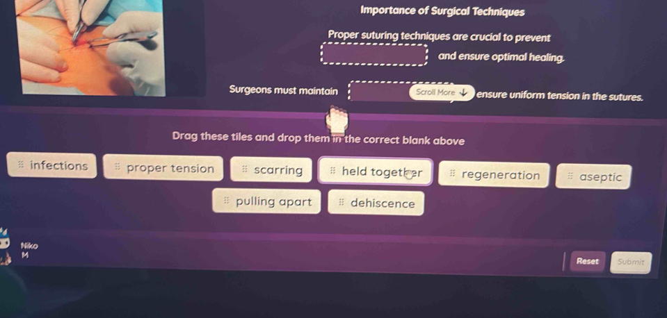 Importance of Surgical Techniques
Proper suturing techniques are crucial to prevent
and ensure optimal healing.
Surgeons must maintain Scroll More ensure uniform tension in the sutures.
Drag these tiles and drop them in the correct blank above
infections proper tension scarring # held together regeneration aseptic
pulling apart dehiscence
Niko Submit
Reset