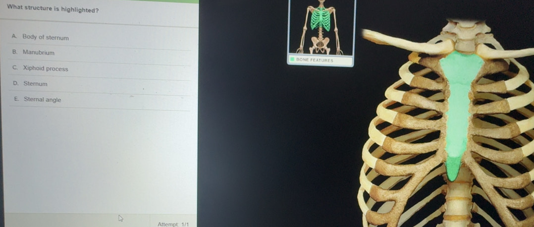 Solved: What structure is highlighted? A. Body of sternum B. Manubrium ...