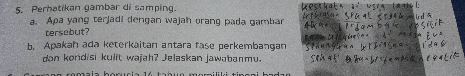 Perhatikan gambar di samping. 
a. Apa yang terjadi dengan wajah orang pada gambar 
tersebut? 
b. Apakah ada keterkaitan antara fase perkembangan 
dan kondisi kulit wajah? Jelaskan jawabanmu. 
maía borucia 14 tabun momiliki tin g