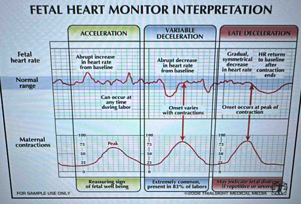 FETAL HEART MONITOR INTERPRETATION