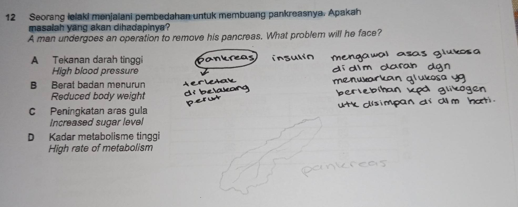 Seorang lelaki menjalani pembedahan untuk membuang pankreasnya. Apakah
masalah yang akan dihadapinya?
A man undergoes an operation to remove his pancreas. What problem will he face?
A Tekanan darah tinggi
High blood pressure
B Berat badan menurun
Reduced body weight
C Peningkatan aras gula
Increased sugar level
D Kadar metabolisme tinggi
High rate of metabolism