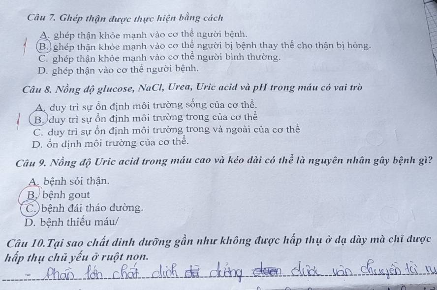 Ghép thận được thực hiện bằng cách
A. ghép thận khỏe mạnh vào cơ thể người bệnh.
B. ghép thận khỏe mạnh vào cơ thể người bị bệnh thay thế cho thận bị hỏng.
C. ghép thận khỏe mạnh vào cơ thể người bình thường.
D. ghép thận vào cơ thể người bệnh.
Câu 8. Nồng độ glucose, NaCl, Urea, Uric acid và pH trong máu có vai trò
A. duy trì sự ổn định môi trường sống của cơ thể.
Bộ duy trì sự ổn định môi trường trong của cơ thể
C. duy trì sự ổn định môi trường trong và ngoài của cơ thể
D. ổn định môi trường của cơ thể.
Câu 9. Nồng độ Uric acid trong máu cao và kéo dài có thể là nguyên nhân gây bệnh gì?
A bệnh sỏi thận.
Bộ bệnh gout
C. ) bệnh đái tháo đường.
D. bệnh thiếu máu/
Câu 10.Tại sao chất dinh dưỡng gần như không được hấp thụ ở dạ dày mà chỉ được
hấp thụ chủ yếu ở ruột non.
_
