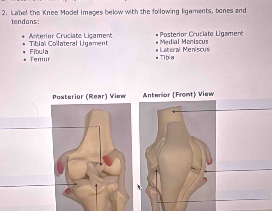 Label the Knee Model images below with the following ligaments, bones and 
tendons: 
Anterior Cruciate Ligament Posterior Cruciate Ligament 
Tibial Collateral Ligament Medial Meniscus 
Fibula Lateral Meniscus 
Femur Tibia 
nterior (Front) View