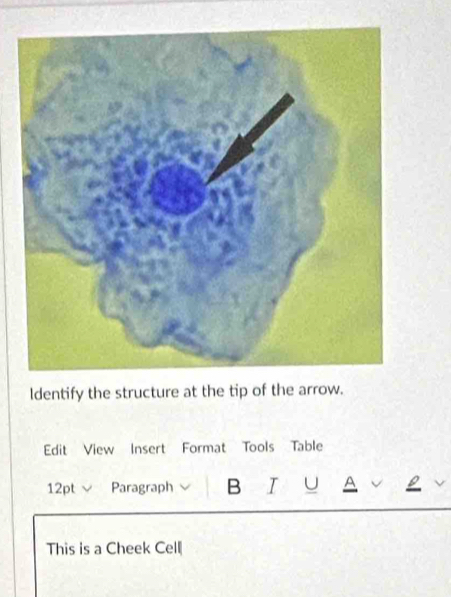 ldentify the structure at the tip of the arrow. 
Edit View Insert Format Tools Table 
12pt √ Paragraph B I U A 
This is a Cheek Cell