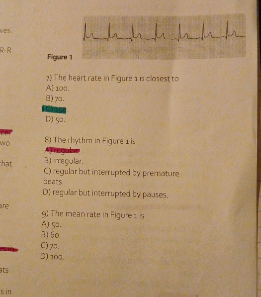 ves. 
R-R
Figure
7) The heart rate in Figure 1 is closest to
A) 100.
B) 70.
wst
D) 50.
C
wo 8) The rhythm in Figure 1 is
A) regular.
:hat B) irregular.
C) regular but interrupted by premature
beats.
D) regular but interrupted by pauses.
are
9) The mean rate in Figure 1 is
A) 50.
B) 60.
C) 70.
D) 100.
ats
s in