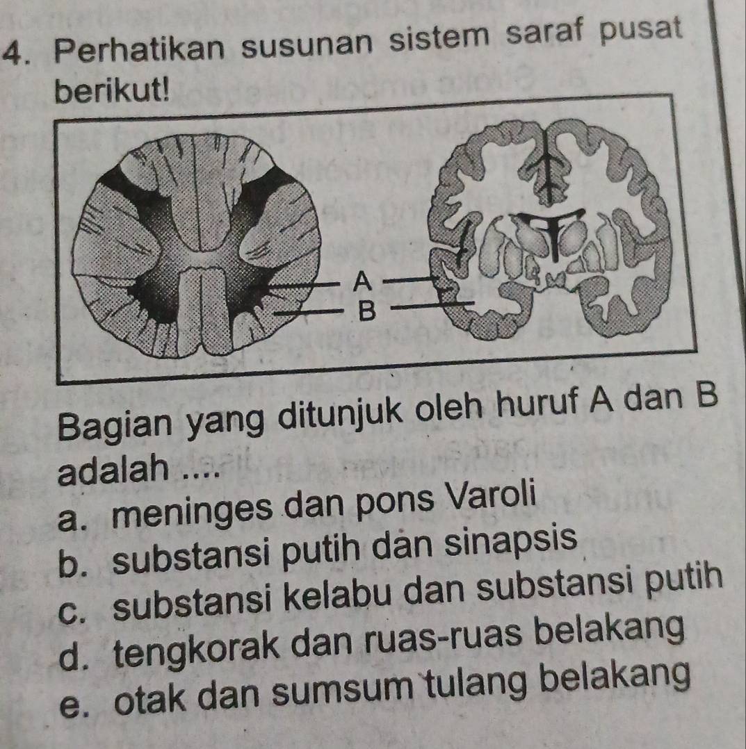 Perhatikan susunan sistem saraf pusat
Bagian yang ditunjuk oleh huruf A dan B
adalah ....
a. meninges dan pons Varoli
b. substansi putih dan sinapsis
c. substansi kelabu dan substansi putih
d. tengkorak dan ruas-ruas belakang
e. otak dan sumsum tulang belakang