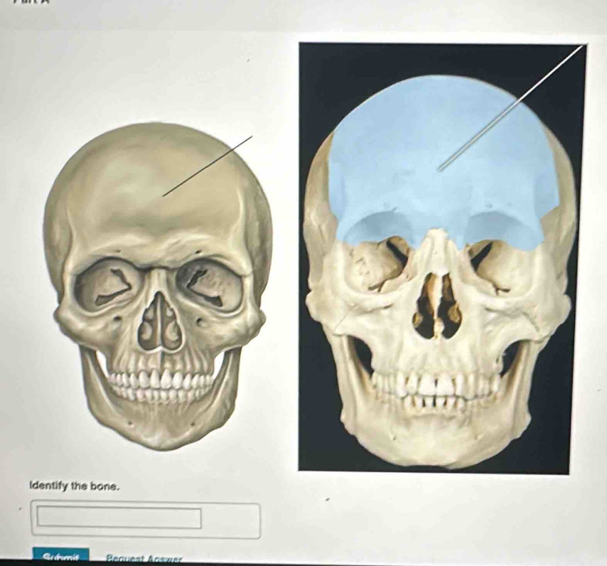 Identify the bone. 
Qunmit Bequest Aoswer