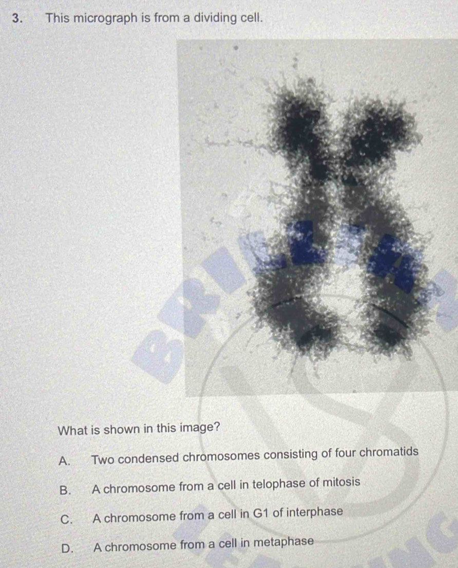 This micrograph is from a dividing cell.
What is shown in this image?
A. Two condensed chromosomes consisting of four chromatids
B. A chromosome from a cell in telophase of mitosis
C. A chromosome from a cell in G1 of interphase
D. A chromosome from a cell in metaphase