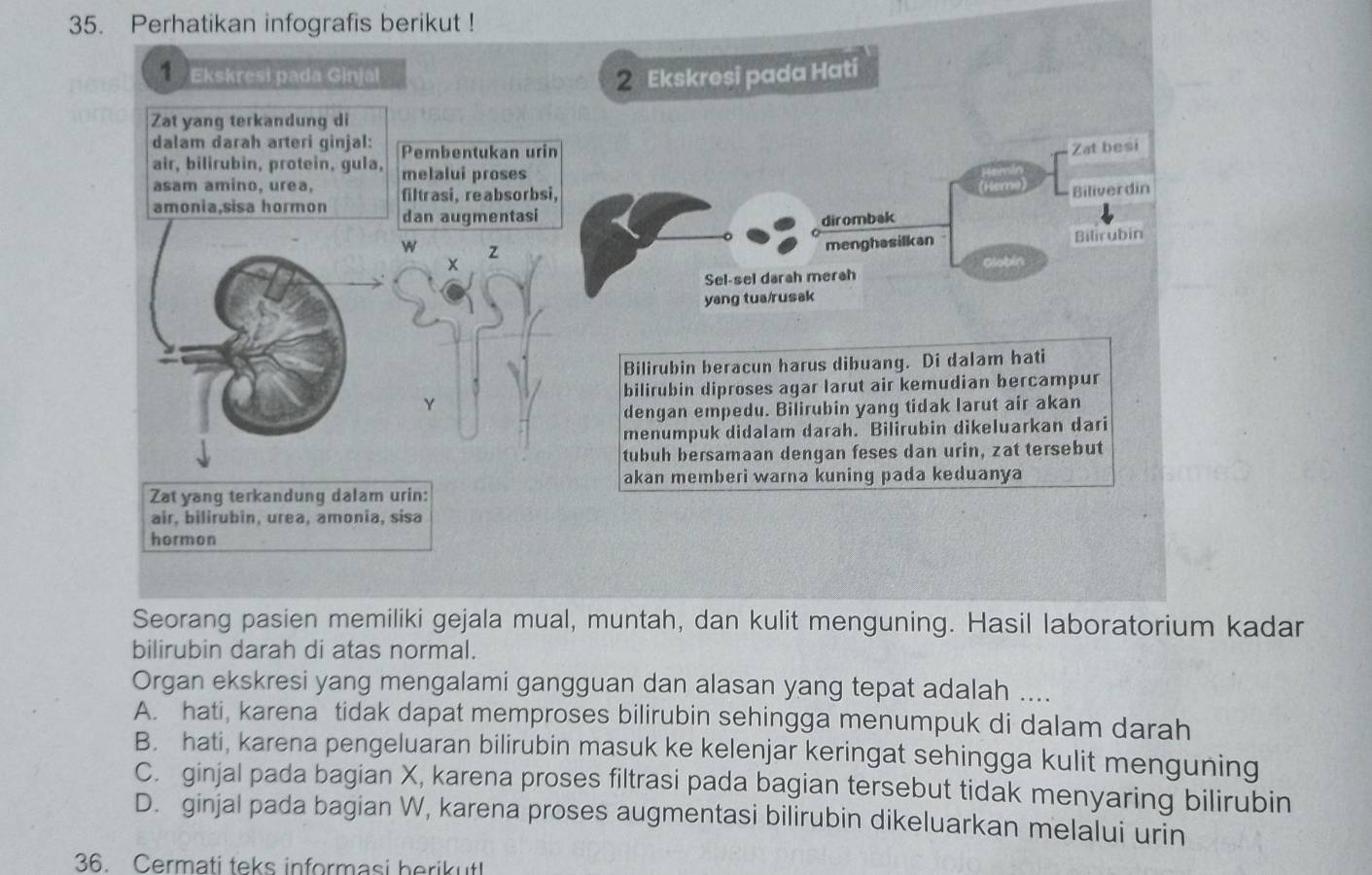 Perhatikan infografis berikut !
Ekskresi pada Ginjal
2 Ekskresi pada Hati
Zat yang terkandung di
dalam darah arteri ginjal: Pembentukan urin Zat besi
air, bilirubin, protein, gula,
asam amino, urea, melalui proses
amonia,sisa hormon filtrasi, reabsorbsi,
Biliverdin
dan augmentasi
dirombak
w z
menghasilkan Bilirubin
Sel-sel darah merah Globin
yang tua/rusak
Bilirubin beracun harus dibuang. Di dalam hati
bilirubin diproses agar larut air kemudian bercampur
Y
dengan empedu. Bilirubin yang tidak larut air akan
menumpuk didalam darah. Bilirubin dikeluarkan dari
tubuh bersamaan dengan feses dan urin, zat tersebut
akan memberi warna kuning pada keduanya
Zat yang terkandung dalam urin:
air, bilirubin, urea, amonia, sisa
hormon
Seorang pasien memiliki gejala mual, muntah, dan kulit menguning. Hasil laboratorium kadar
bilirubin darah di atas normal.
Organ ekskresi yang mengalami gangguan dan alasan yang tepat adalah ....
A. hati, karena tidak dapat memproses bilirubin sehingga menumpuk di dalam darah
B. hati, karena pengeluaran bilirubin masuk ke kelenjar keringat sehingga kulit menguning
C. ginjal pada bagian X, karena proses filtrasi pada bagian tersebut tidak menyaring bilirubin
D. ginjal pada bagian W, karena proses augmentasi bilirubin dikeluarkan melalui urin
36. Cermati teks informasi berikut!