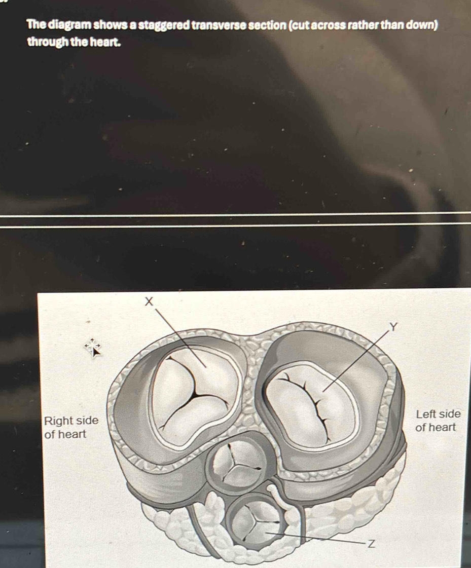 Solved: The diagram shows a staggered transverse section (cut across ...