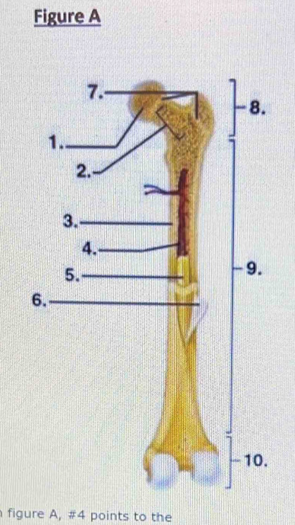 Figure A 
figure A, #4 points to the