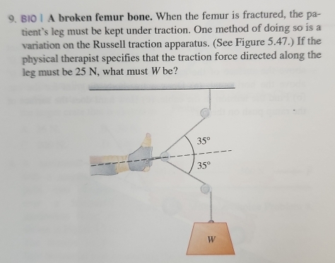 BI0 | A broken femur bone. When the femur is fractured, the pa-
tient's leg must be kept under traction. One method of doing so is a
variation on the Russell traction apparatus. (See Figure 5.47.) If the
physical therapist specifies that the traction force directed along the
leg must be 25 N, what must W be?