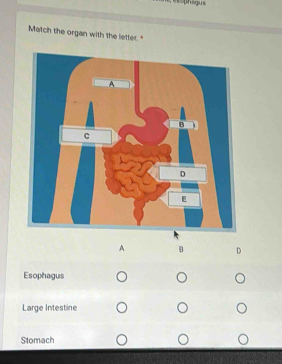 Match the organ with the letter. "
A B D
Esophagus
Large Intestine
Stomach