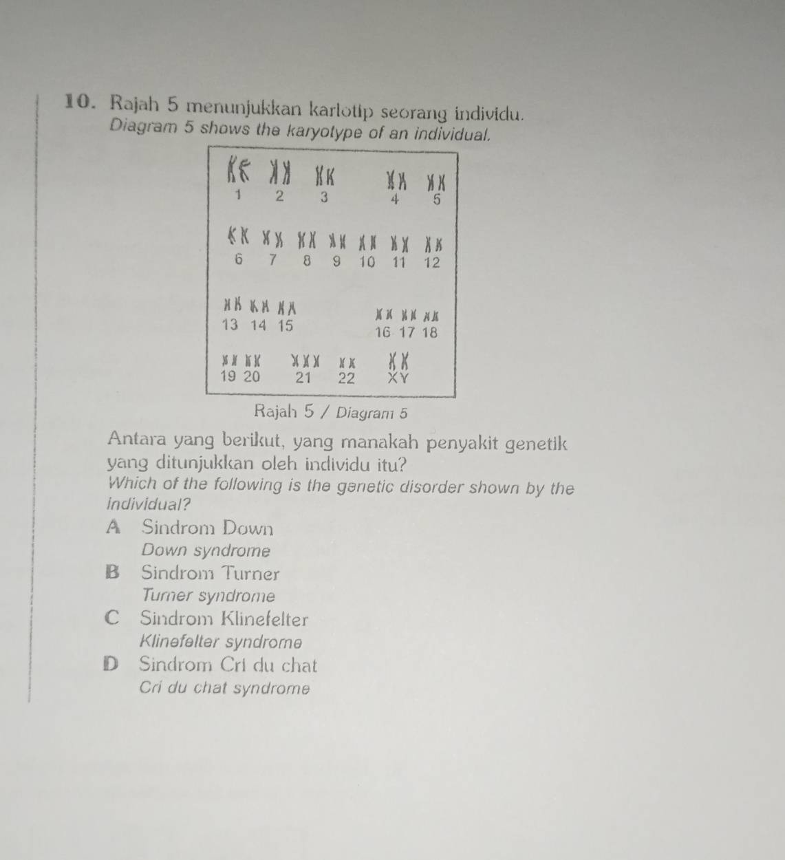 Rajah 5 menunjukkan karlotip seorang individu.
Diagram 5 shows the karyotype of an indial.
Rajah 5 / Diagram 5
Antara yang berikut, yang manakah penyakit genetik
yang ditunjukkan oleh individu itu?
Which of the following is the ganetic disorder shown by the
individual?
A Sindrom Down
Down syndrome
B Sindrom Turner
Turner syndrome
C Sindrom Klinefelter
Klinefelter syndrome
D Sindrom Cri du chat
Cri du chat syndrome