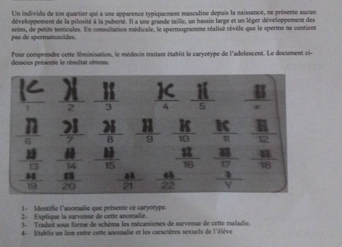 Un individu de ton quartier qui a une apparence typiquement masculine depuis la naissance, ne présente aucun
développement de la pilosité à la puberté. Il a une grande taille, un bassin large et un léger développement des
seins, de petits testicules. En consultation médicale, le spermogramme réalisé révèle que le sperme ne contient
pas de spermatozoïdes.
Pour comprendre cette féminisation, le médecin traitant établit le caryotype de l'adolescent. Le document ci-
dessous présente le résultat obtenu.
l- Identifie l’anomalie que présente ce caryotype.
2- Explique la survenue de cette anomalie.
3- Traduit sous forme de schéma les mécanismes de survenue de cette maladie.
4- Etablis un lien entre cette anomalie et les caractères sexuels de l'élève