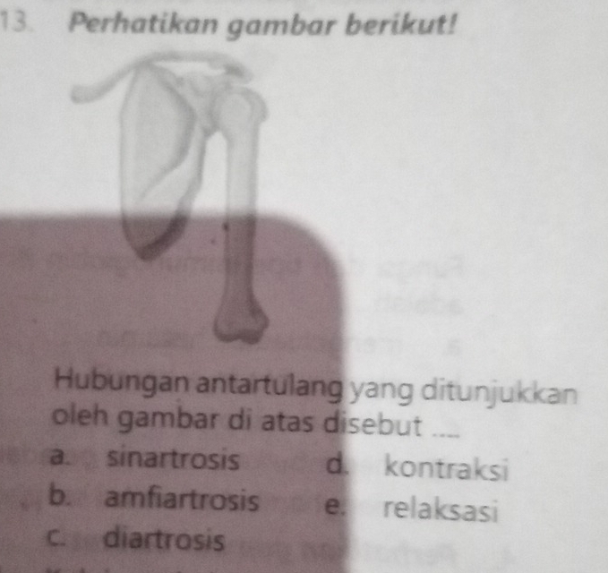 Perhatikan gambar berikut!
Hubungan antartulang yang ditunjukkan
oleh gambar di atas disebut ....
as sinartrosis d. kontraksi
b. amfiartrosis e. relaksasi
c. diartrosis