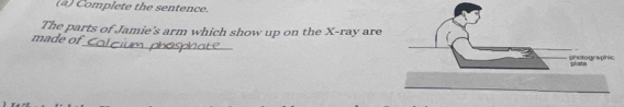 Complete the sentence. 
The parts of Jamie's arm which show up on the X -ray are 
made of_ Calcium phosphate I