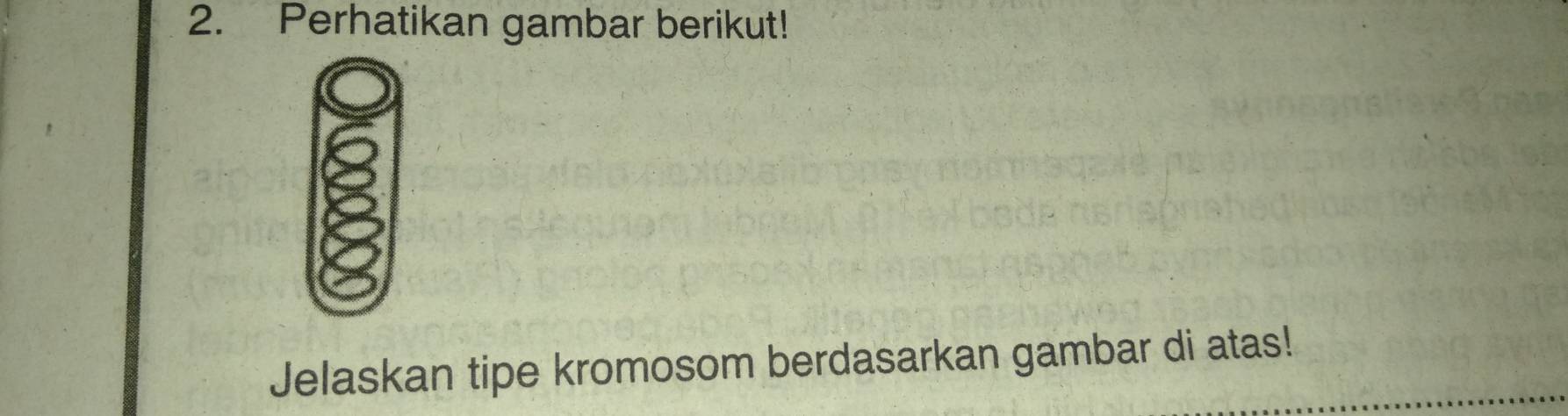 Perhatikan gambar berikut! 
Jelaskan tipe kromosom berdasarkan gambar di atas!