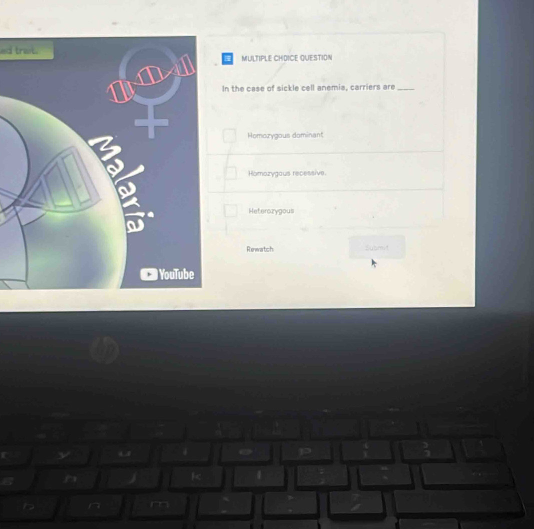 ed trait.
MULTIPLE CHOICE QUESTION
In the case of sickle cell anemia, carriers are_
Homozygous dominant
Homozygous recessive.
Heterozygous
Rewatch Submit
4
4