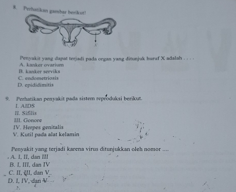 Perhatikan gambar berikut!
Penyakit yang dapat terjadi pada organ yang ditunjuk huruf X adalah . . . .
A. kanker ovarium
B. kanker serviks
C. endometriosis
D. epididimitis
9. Perhatikan penyakit pada sistem reproduksi berikut.
I. AIDS
II. Sifilis
III. Gonore
IV. Herpes genitalis
V. Kutil pada alat kelamin
Penyakit yang terjadi karena virus ditunjukkan oleh nomor ....
A. I, II, dan III
B. I, III, dan IV
C. II, III, dan V
D. I, IV,·dan V
, .