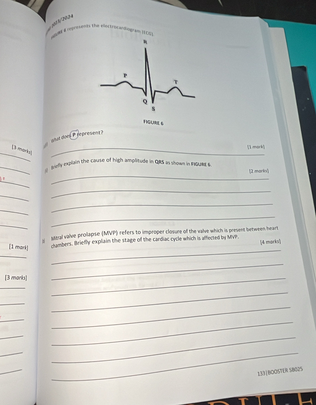 ASURE 6 represents the electrocardiogram 
((6) 
FIGURE 6 
What does P represent? 
[1 mark] 
_ 
[3 marks]_ 
_ 
_(i) Briefly explain the cause of high amplitude in QRS as shown in FIGURE 6. 
(2 marks] 
_ 
e 
_ 
_ 
_ 
_ 
_ 
_ 
# Mitral valve prolapse (MVP) refers to improper closure of the valve which is present between heart 
[4 marks] 
_ 
[1 mark] chambers. Briefly explain the stage of the cardiac cycle which is affected by MVP. 
_ 
[3 marks] 
_ 
_ 
_ 
_ 
_ 
_ 
_ 
_ 
_ 
_ 
_ 
_ 
_ 
133|BOOSTER SB025