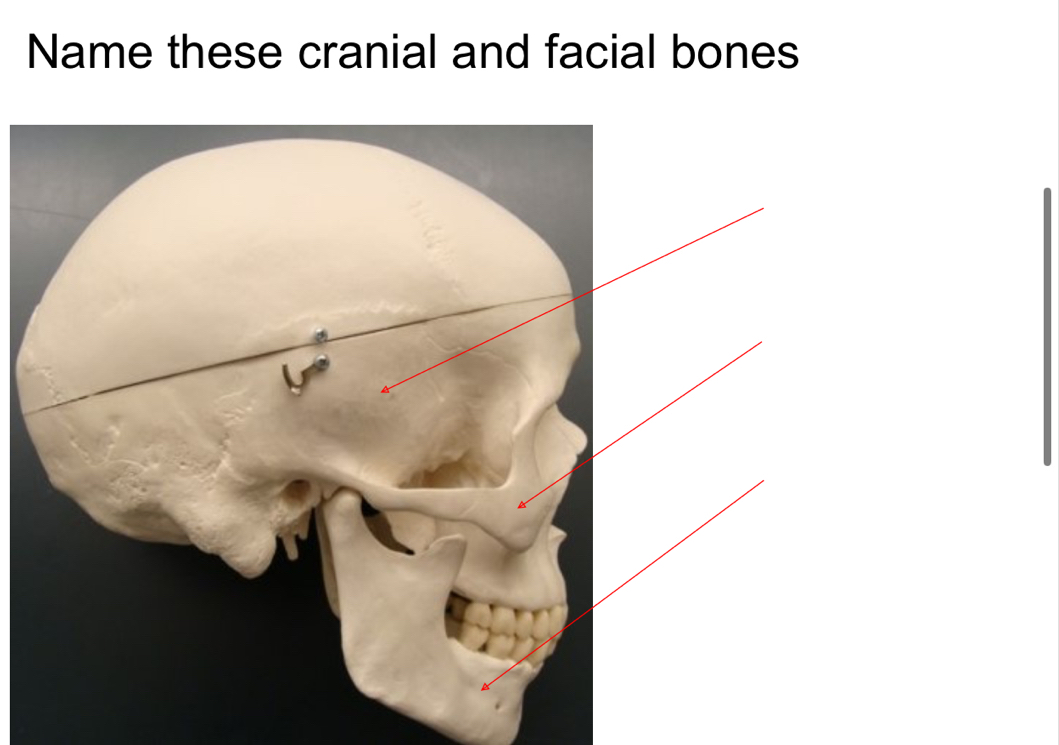 Name these cranial and facial bones