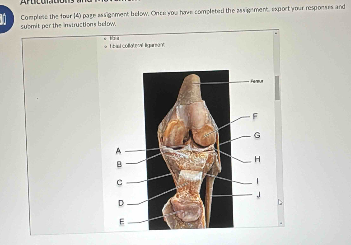 Articulations 
1 Complete the four (4) page assignment below. Once you have completed the assignment, export your responses and 
submit per the instructions below. 
tibia 
tibial collateral ligament