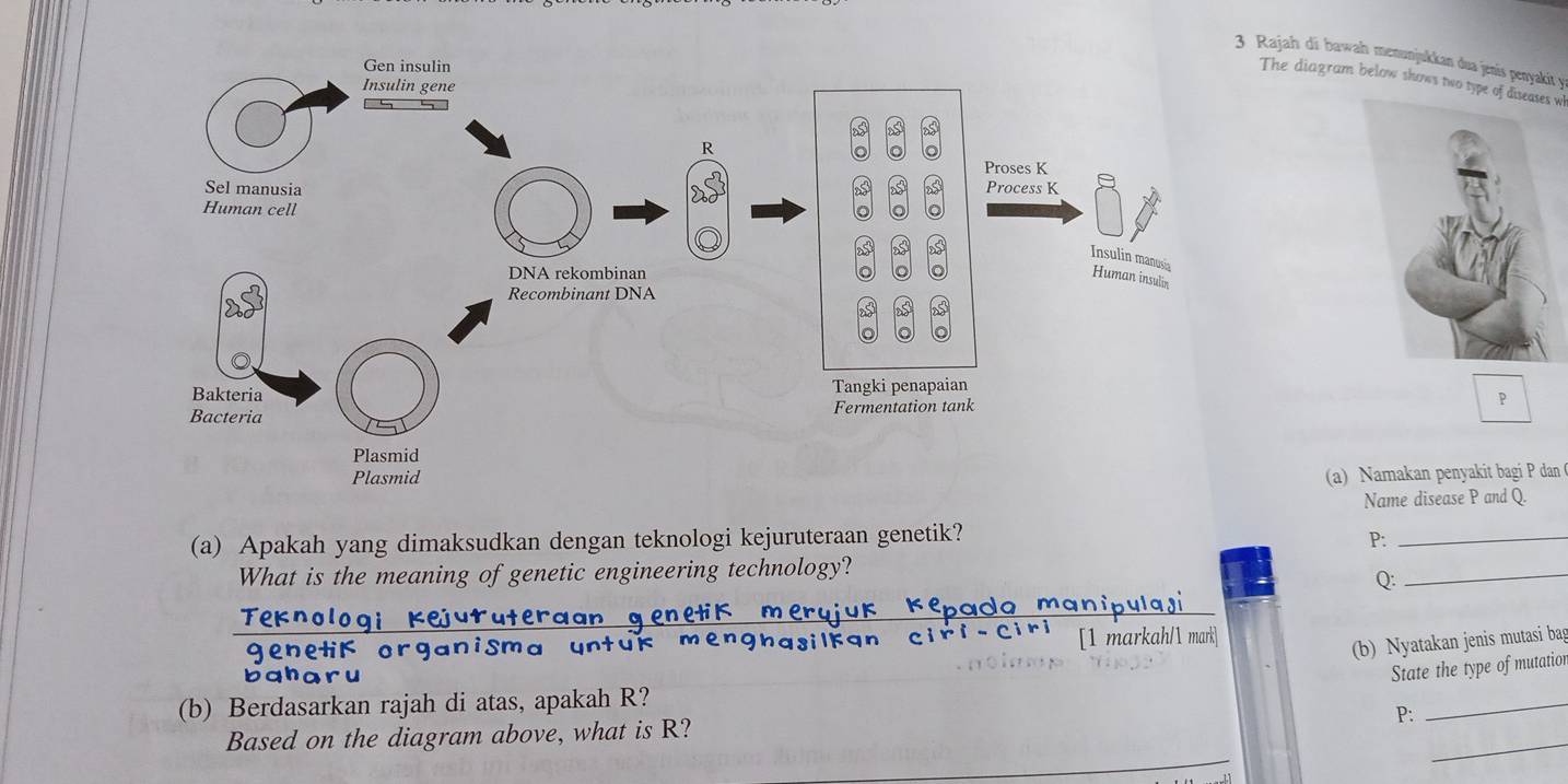Selesai:Rajah di bawah menunjukkan dua jenis penyakit y The diagram ...