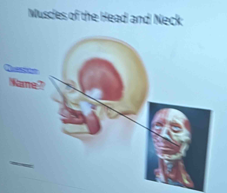 es of the Head and Neck