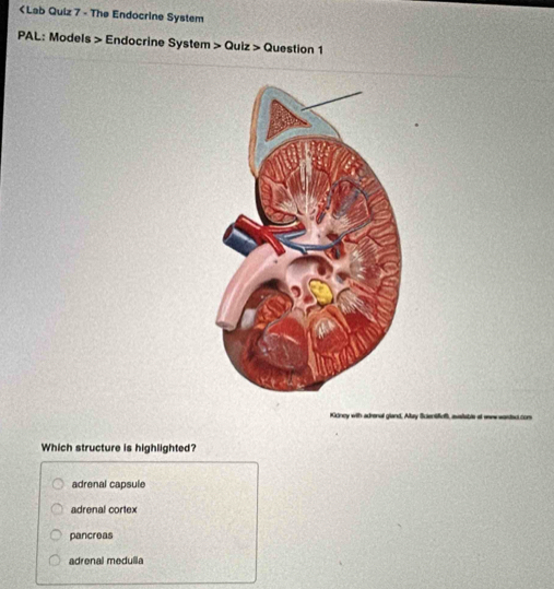 < Lab Quiz 7 - The Endocrine System
PAL: Models > Endocrine System Oulz> Question 1
_
Which structure is highlighted?
adrenal capsule
adrenal cortex
pancreas
adrenal medulla