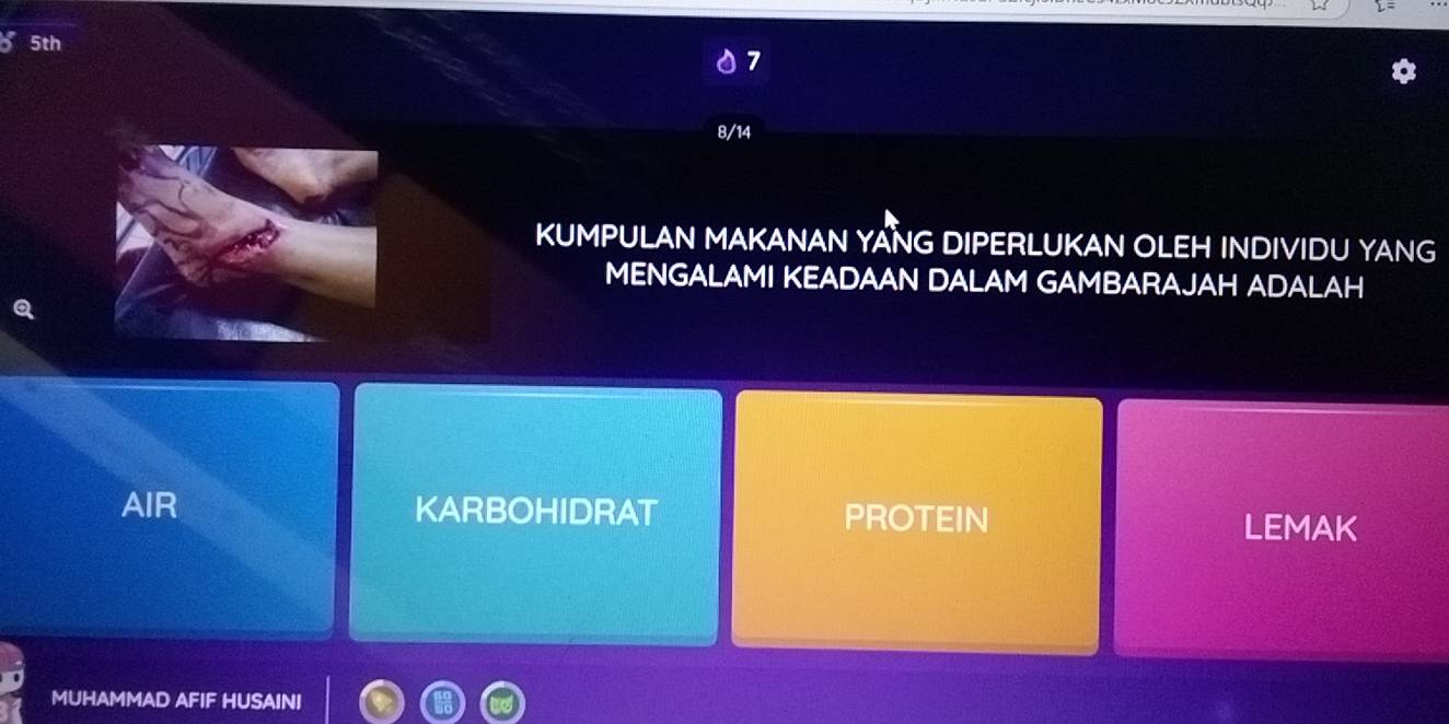 5th
7
8/14
KUMPULAN MAKANAN YANG DIPERLUKAN OLEH INDIVIDU YANG
MENGALAMI KEADAAN DALAM GAMBARAJAH ADALAH

AIR KARBOHIDRAT PROTEIN
LEMAK
MUHAMMAD AFIF HUSAINI