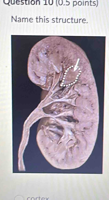 Name this structure. 
cortex