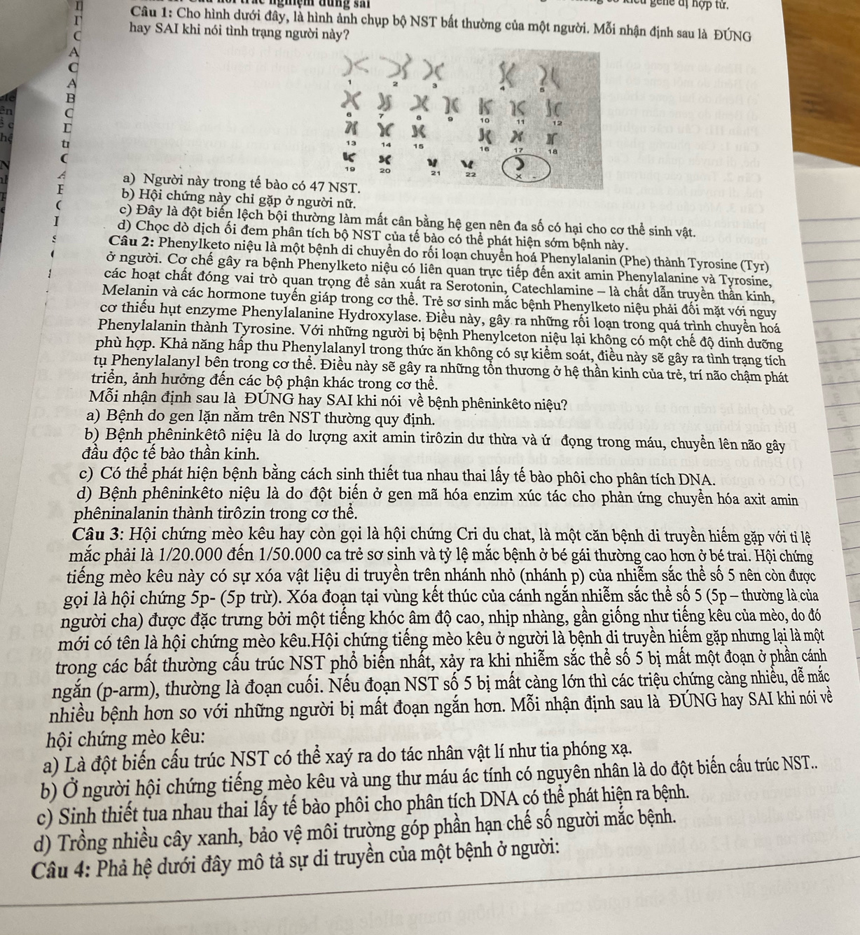 gene đị hợp từ
11  Câu 1: Cho hình dưới đây, là hình ảnh chụp bộ NST bất thường của một người. Mỗi nhận định sau là ĐÚNG
hay SAI khi nói tình trạng người này?
R
ân
r
he
t
a) Người này trong tế bào có
b) Hội chứng này chỉ gặp ở người nữ.
c) Đây là đột biến lệch bội thường làm mất cân bằng hệ gen nên đa số có hại cho cơ thể sinh vật.
d) Chọc dò dịch ối đem phân tích bộ NST của tế bào có thể phát hiện sớm bệnh này.
Câu 2: Phenylketo niệu là một bệnh di chuyển do rối loạn chuyển hoá Phenylalanin (Phe) thành Tyrosine (Tyr)
ở người. Cơ chế gây ra bệnh Phenylketo niệu có liên quan trực tiếp đến axit amin Phenylalanine và Tyrosine,
các hoạt chất đóng vai trò quan trọng đề sản xuất ra Šerotonin, Catechlamine - là chất dẫn truyền thần kinh,
Melanin và các hormone tuyến giáp trong cơ thể. Trẻ sơ sinh mắc bệnh Phenylketo niệu phải đối mặt với nguy
cơ thiếu hụt enzyme Phenylalanine Hydroxylase. Điều này, gây ra những rối loạn trong quá trình chuyển hoá
Phenylalanin thành Tyrosine. Với những người bị bệnh Phenylceton niệu lại không có một chế độ dinh dưỡng
phù hợp. Khả năng hấp thu Phenylalanyl trong thức ăn không có sự kiểm soát, điều này sẽ gây ra tình trạng tích
tụ Phenylalanyl bên trong cơ thể. Điều này sẽ gây ra những tồn thương ở hệ thần kinh của trẻ, trí não chậm phát
triển, ảnh hưởng đến các bộ phận khác trong cơ thể.
Mỗi nhận định sau là ĐÚNG hay SAI khi nói về bệnh phêninkêto niệu?
a) Bệnh do gen lặn nằm trên NST thường quy định.
b) Bệnh phêninkệtô niệu là do lượng axit amin tirôzin dư thừa và ứ đọng trong máu, chuyển lên não gây
đầu độc tế bào thần kinh.
c) Có thể phát hiện bệnh bằng cách sinh thiết tua nhau thai lấy tế bào phôi cho phân tích DNA.
d) Bệnh phêninkêto niệu là do đột biến ở gen mã hóa enzim xúc tác cho phản ứng chuyền hóa axit amin
phêninalanin thành tirôzin trong cơ thể.
Câu 3: Hội chứng mèo kêu hay còn gọi là hội chứng Cri du chat, là một căn bệnh di truyền hiếm gặp với tỉ lệ
mắc phải là 1/20.000 đến 1/50.000 ca trẻ sơ sinh và tỷ lệ mắc bệnh ở bé gái thường cao hơn ở bé trai. Hội chứng
tiếng mèo kêu này có sự xóa vật liệu di truyền trên nhánh nhỏ (nhánh p) của nhiễm sắc thể số 5 nên còn được
gọi là hội chứng 5p- (5p trừ). Xóa đoạn tại vùng kết thúc của cánh ngắn nhiễm sắc thể số 5 (5p − thường là của
người cha) được đặc trưng bởi một tiếng khóc âm độ cao, nhịp nhàng, gần giống như tiếng kêu của mèo, do đó
mới có tên là hội chứng mèo kêu.Hội chứng tiếng mèo kêu ở người là bệnh di truyền hiếm gặp nhưng lại là một
trong các bất thường cấu trúc NST phổ biến nhất, xảy ra khi nhiễm sắc thể số 5 bị mất một đoạn ở phần cánh
ngắn (p-arm), thường là đoạn cuối. Nếu đoạn NST số 5 bị mất càng lớn thì các triệu chứng càng nhiều, dễ mắc
nhiều bệnh hơn so với những người bị mất đoạn ngắn hơn. Mỗi nhận định sau là ĐÚNG hay SAI khi nói về
hội chứng mèo kêu:
a) Là đột biến cấu trúc NST có thể xaý ra do tác nhân vật lí như tia phóng xạ.
b) Ở người hội chứng tiếng mèo kêu và ung thư máu ác tính có nguyên nhân là do đột biến cấu trúc NST...
c) Sinh thiết tua nhau thai lấy tế bào phôi cho phân tích DNA có thể phát hiện ra bệnh.
d) Trồng nhiều cây xanh, bảo vệ môi trường góp phần hạn chế số người mắc bệnh.
Câu 4: Phả hệ dưới đây mô tả sự di truyền của một bệnh ở người: