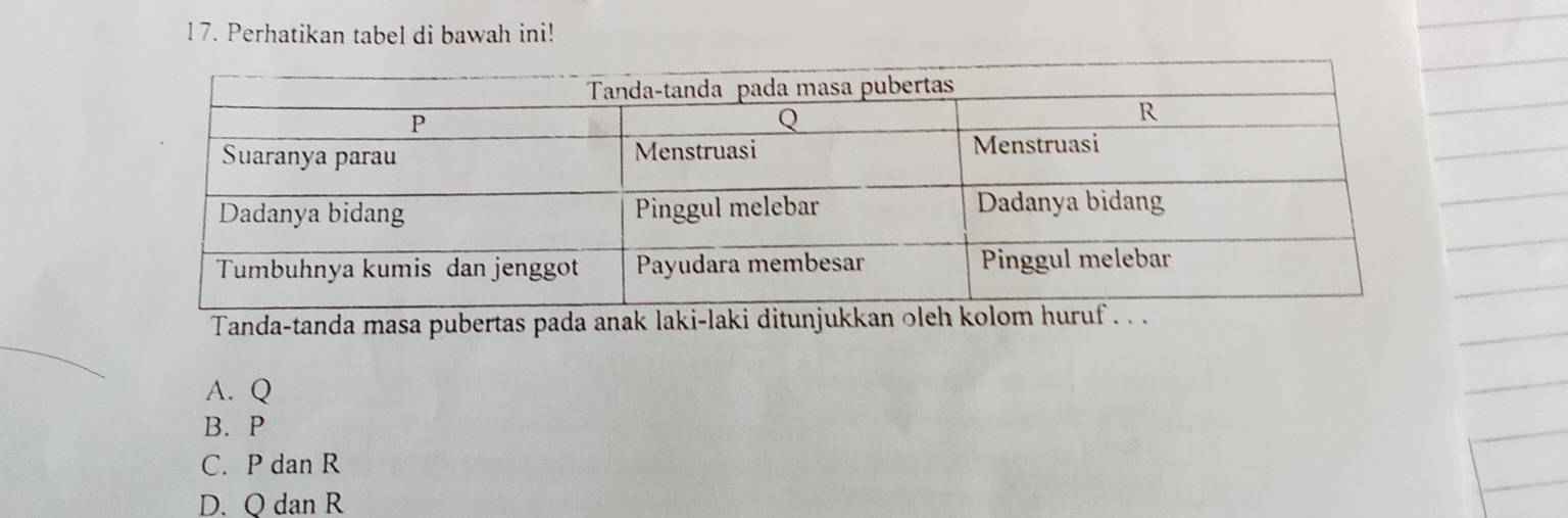 Perhatikan tabel di bawah ini!
Tanda-tanda masa pubertas pada anak laki-laki ditunjukkan oleh
A. Q
B. P
C. P dan R
D. Q dan R