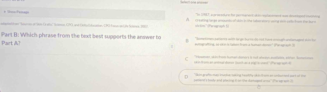 Select one answer
* Show Passage "In 1987, a procedure for permanent skin replacement was developed involving
A creating large amounts of skin in the laboratory using skin cells from the burn
adopted from ''Sources of Skin Grafts." Science, CPO, and Delta Education, CPO Foous on Life Science, 2007, victim.' (Paragraph 5)
Part B: Which phrase from the text best supports the answer to B *Sometimes patients with large burns do not have enough undamaged skin for
Part A? autografting, so skin is taken from a human donor." (Paragraph 3)
=
C "However, skin from human donors is not always available, either. Sometimes
skin from an animal donor (such as a pig) is used." (Paragraph 4)
"Skin grafts may involve taking healthy skin from an unburned part of the
D patient's body and placing it on the damaged area." (Paragraph 2)