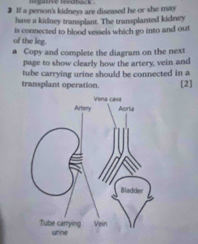 negative teedback . 
3 If a person's kidneys are diseased he or she may 
have a kidney transplant. The transplanted kidney 
is connected to blood vessels which go into and out 
of the leg. 
a Copy and complete the diagram on the next 
page to show clearly how the artery, vein and 
tube carrying urine should be connected in a 
transplant operation. [2]