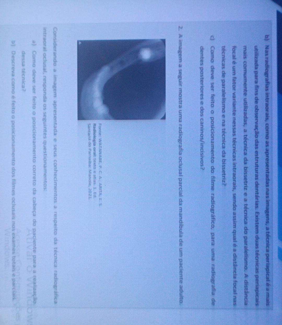 Nas radiografias intraorais, como as apresentadas nas imagens, a técnica periapical é a mais 
utilizada para fins de observação das estruturas dentárias. Existem duas técnicas periapicais 
mais comumente utilizadas, a técnica da bissetriz e a técnica do paralelismo. A distância 
focal é um fator variante nessas técnicas intraorais, sendo assim qual é a distância focal nas 
técnicas de paralelismo e na técnica da bissetriz? 
c) Como deve ser feito o posicionamento do filme radiográfico, para uma radiografia de 
dentes posteriores e dos caninos/incisivos? 
2. A imagem a seguir mostra uma radiografia oclusal parcial da mandíbula de um paciente adulto. 
onte: WATANABE, P. C. A.; ARITA, E. S. 
adiología oral: texto e atlas. 1. Ed; 
antana do Parnaíba: Manole, 2021. 
Considerando a imagem apresentada e seus conhecimentos a respeito da técnica radiográfica 
intraoral oclusal, responda os seguintes questionamentos: 
a) Como deve ser feito o posicionamento correto da cabeça do paciente para a realização. 
dessa técnica? 
b) Descreva como é feito o posicionamento dos filmes oclusais nos exames to é é parciais