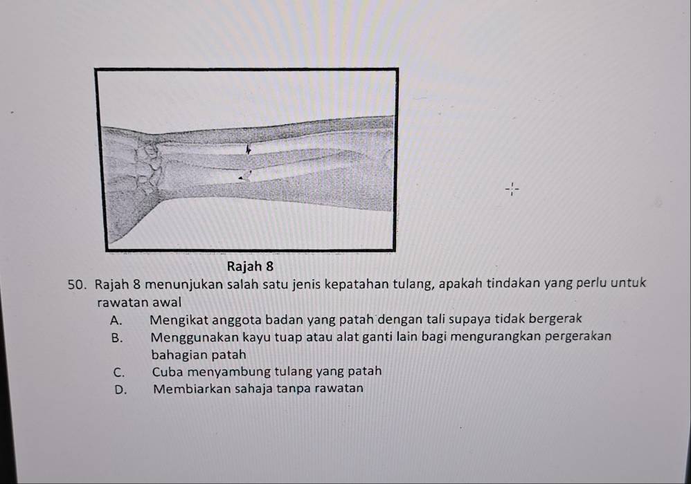 Rajah 8 menunjukan salah satu jenis kepatahan tulang, apakah tindakan yang perlu untuk
rawatan awal
A. Mengikat anggota badan yang patah dengan tali supaya tidak bergerak
B. Menggunakan kayu tuap atau alat ganti lain bagi mengurangkan pergerakan
bahagian patah
C. Cuba menyambung tulang yang patah
D. Membiarkan sahaja tanpa rawatan